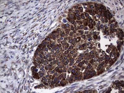 Immunohistochemistry: Metadherin Antibody (OTI1B6) [NBP2-46026]