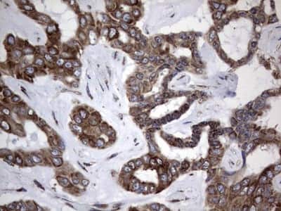 Immunohistochemistry: Metadherin Antibody (OTI1B6) [NBP2-46026]