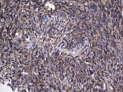 Immunohistochemistry: Metadherin Antibody (OTI1B6) [NBP2-46026]