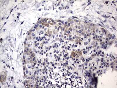 Immunohistochemistry: Metadherin Antibody (OTI1B6) [NBP2-46026]