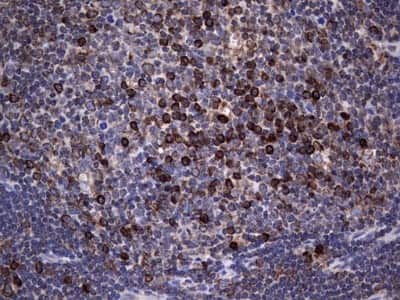 Immunohistochemistry: Metadherin Antibody (OTI1B6) [NBP2-46026]