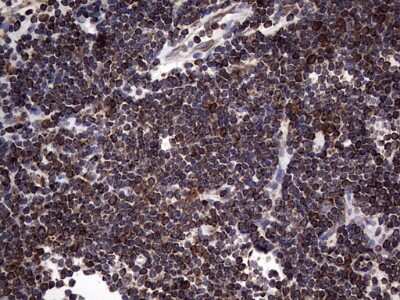 Immunohistochemistry: Metadherin Antibody (OTI1B6) [NBP2-46026]