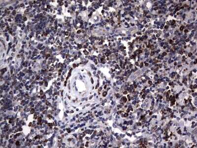 Immunohistochemistry: Metadherin Antibody (OTI1B6) [NBP2-46026]