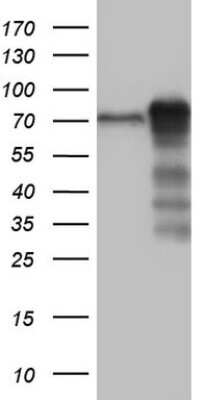 Western Blot: Metadherin Antibody (OTI1B6) [NBP2-46026]