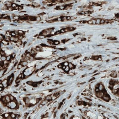 Immunohistochemistry-Paraffin: Metadherin Antibody (CL0397) [NBP2-52929]