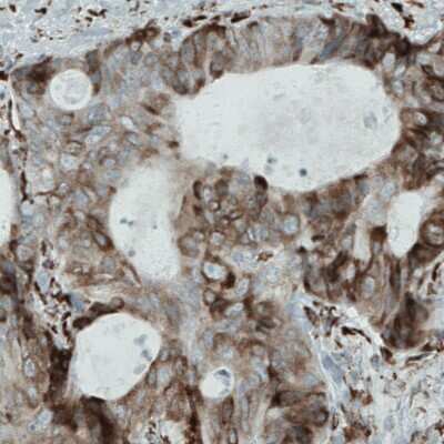 Immunohistochemistry-Paraffin: Metadherin Antibody (CL0397) [NBP2-52929]