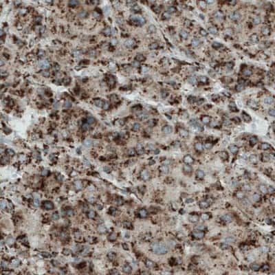 Immunohistochemistry-Paraffin: Metadherin Antibody (CL0397) [NBP2-52929]