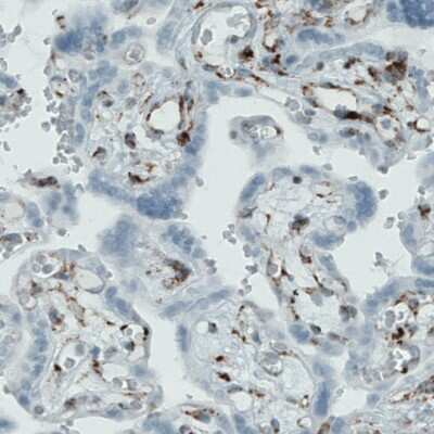 Immunohistochemistry-Paraffin: Metadherin Antibody (CL0397) [NBP2-52929]