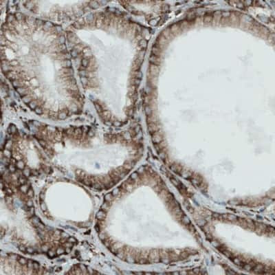 Immunohistochemistry-Paraffin: Metadherin Antibody (CL0397) [NBP2-52929]
