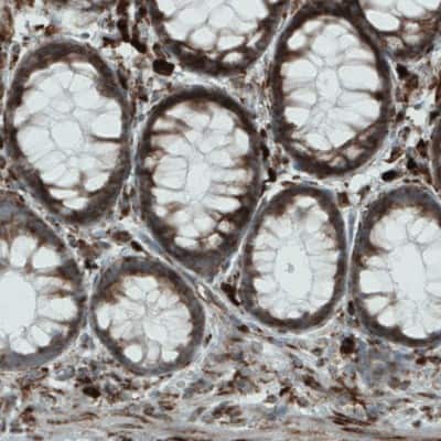 Immunohistochemistry-Paraffin: Metadherin Antibody (CL0397) [NBP2-52929]