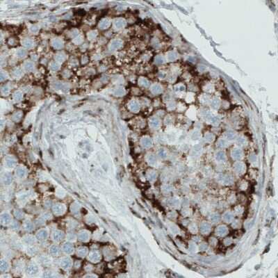 Immunohistochemistry-Paraffin: Metadherin Antibody (CL0397) [NBP2-52929]
