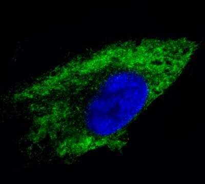 Immunocytochemistry/ Immunofluorescence: Metadherin Antibody (CL0401) [NBP2-30458]