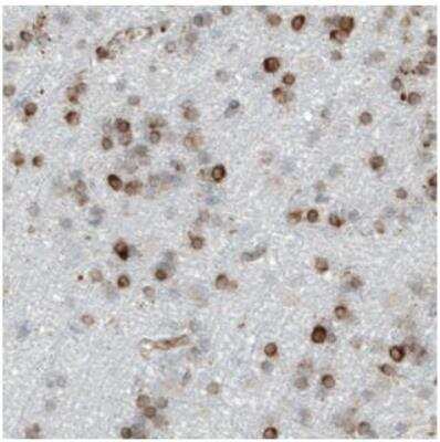 Immunohistochemistry-Paraffin: Metadherin Antibody (CL0401) [NBP2-30458]