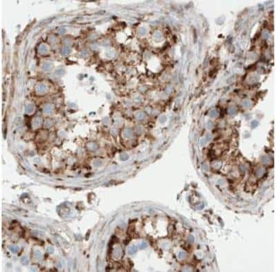 Immunohistochemistry-Paraffin: Metadherin Antibody (CL0401) [NBP2-30458]