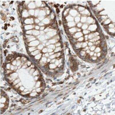 Immunohistochemistry-Paraffin: Metadherin Antibody (CL0401) [NBP2-30458]