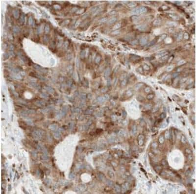 Immunohistochemistry-Paraffin: Metadherin Antibody (CL0401) [NBP2-30458]