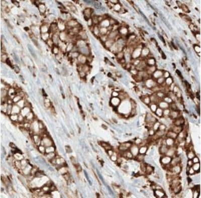 Immunohistochemistry-Paraffin: Metadherin Antibody (CL0401) [NBP2-30458]