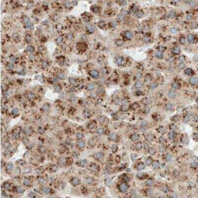 Immunohistochemistry-Paraffin: Metadherin Antibody (CL0401) [NBP2-30458]