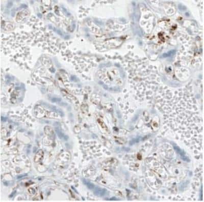 Immunohistochemistry-Paraffin: Metadherin Antibody (CL0401) [NBP2-30458]