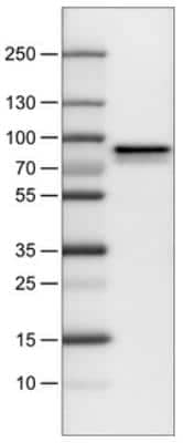 Western Blot: Metadherin Antibody (CL0401) [NBP2-30458]