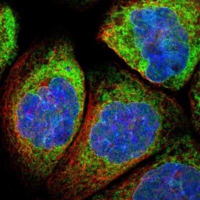 Immunocytochemistry/ Immunofluorescence: Metadherin Antibody [NBP1-90327]