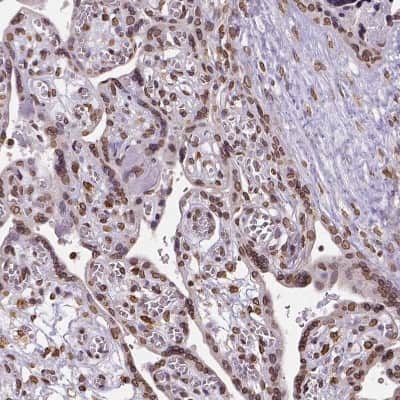 Immunohistochemistry-Paraffin: Metadherin Antibody [NBP1-90327]