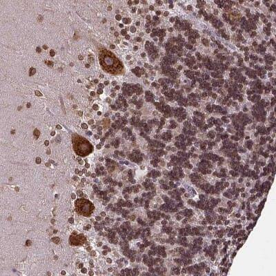 Immunohistochemistry-Paraffin: Metadherin Antibody [NBP1-90327]