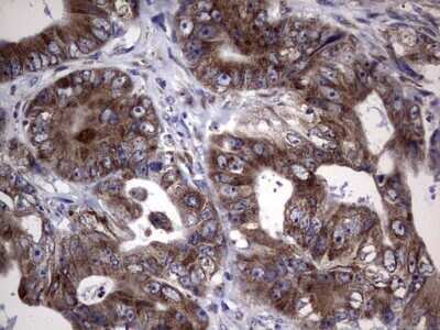 Immunohistochemistry: Metadherin Antibody (OTI1B6) - Azide and BSA Free [NBP2-72552]