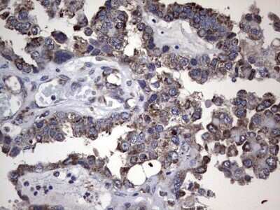 Immunohistochemistry: Metadherin Antibody (OTI1B6) - Azide and BSA Free [NBP2-72552]