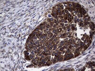 Immunohistochemistry: Metadherin Antibody (OTI1B6) - Azide and BSA Free [NBP2-72552]