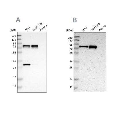 Western Blot: Metadherin Antibody [NBP1-90327]