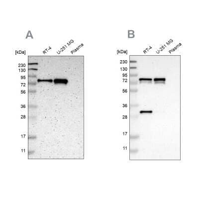 Western Blot: Metadherin Antibody [NBP1-90328]