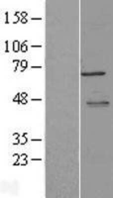 Western Blot: Metadherin Overexpression Lysate [NBL1-13355]