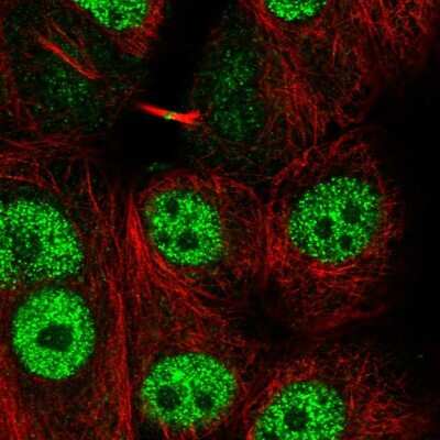 Immunocytochemistry/ Immunofluorescence: LYRM1 Antibody [NBP2-56748]