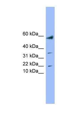 Western Blot: LYRM1 Antibody [NBP1-54901]