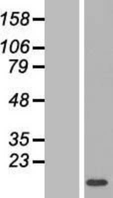 Western Blot: LYRM1 Overexpression Lysate [NBL1-12764]