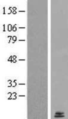 Western Blot: LYRM2 Overexpression Lysate [NBL1-12765]