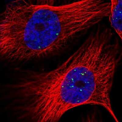 Immunocytochemistry/ Immunofluorescence: LYRM4 Antibody [NBP1-86762]