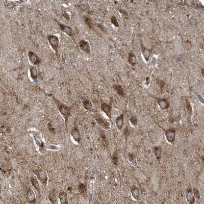 Immunohistochemistry-Paraffin: LYRM4 Antibody [NBP1-86762]