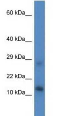 Western Blot: LYRM4 Antibody [NBP1-79672]