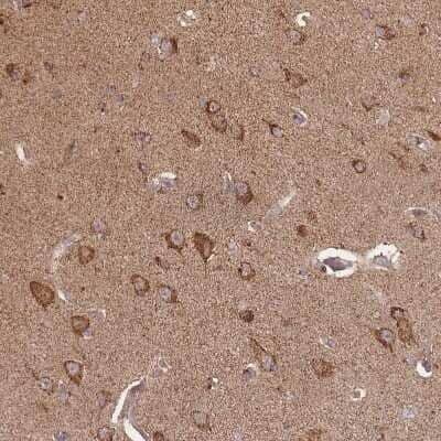 Immunohistochemistry-Paraffin: LYRM7 Antibody [NBP2-14701]