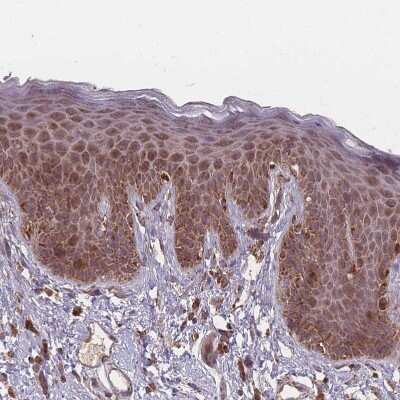 Immunohistochemistry-Paraffin: LYRM7 Antibody [NBP2-14701]