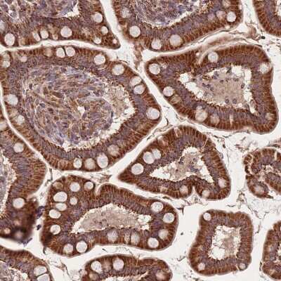 Immunohistochemistry-Paraffin: LYRM7 Antibody [NBP2-14701]