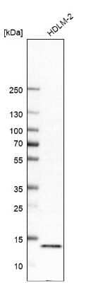 Western Blot: LYRM7 Antibody [NBP2-14701]