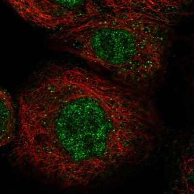 Immunocytochemistry/ Immunofluorescence: LYSMD1 Antibody [NBP1-81095]