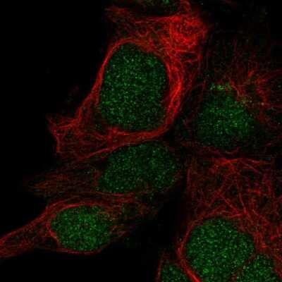 Immunocytochemistry/ Immunofluorescence: LYSMD1 Antibody [NBP2-55871]