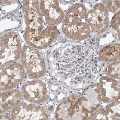 Immunohistochemistry-Paraffin: LYSMD1 Antibody [NBP1-81095]