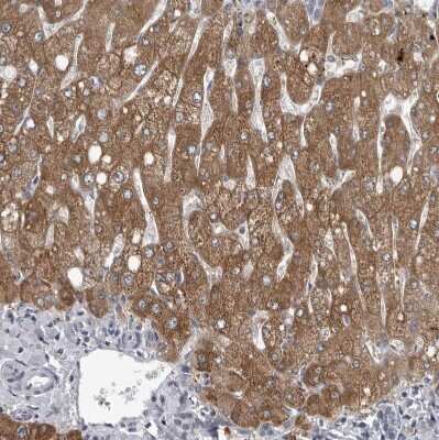 Immunohistochemistry-Paraffin: LYSMD1 Antibody [NBP1-81095]