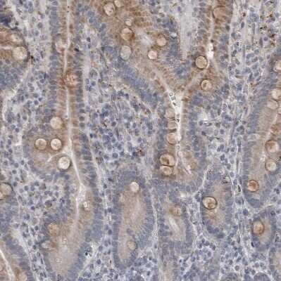 Immunohistochemistry-Paraffin: LYSMD1 Antibody [NBP1-81095]