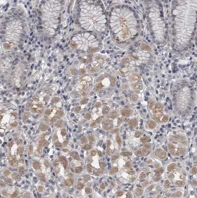 Immunohistochemistry-Paraffin: LYSMD1 Antibody [NBP1-81095]